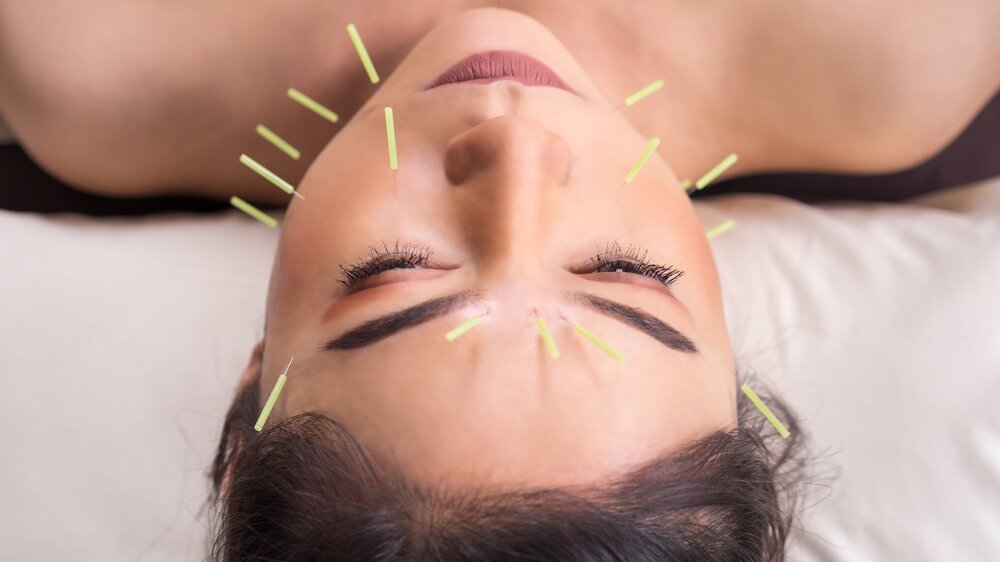 Learn the Ancient Art of Rejuvenation through Facial Acupuncture